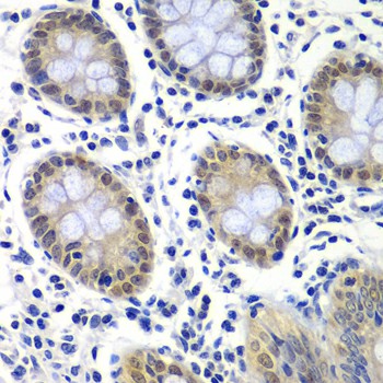 Immunohistochemistry of paraffin-embedded Human colon using GTF2F2 Polyclonal Antibody at dilution of 1:200 (40x lens).