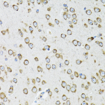 Immunohistochemistry of paraffin-embedded Mouse brain using OGDH Polyclonal Antibody at dilution of 1:100 (40x lens).