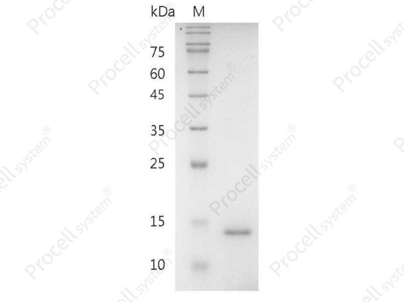 IL-9/HP40, Human, Recombinant