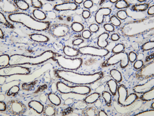 Recombinant NDUFB9 Monoclonal Antibody - 2