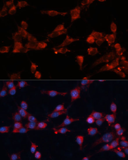 Immunofluorescence analysis of NIH-3T3 cells using eIF3B Polyclonal antibody at dilution of 1:100 (40x lens). Blue: DAPI for nuclear staining.