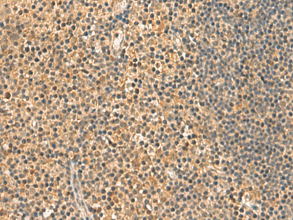 Immunohistochemistry of paraffin-embedded Human tonsil tissue  using UCHL1 Polyclonal Antibody at dilution of 1:60(?200)