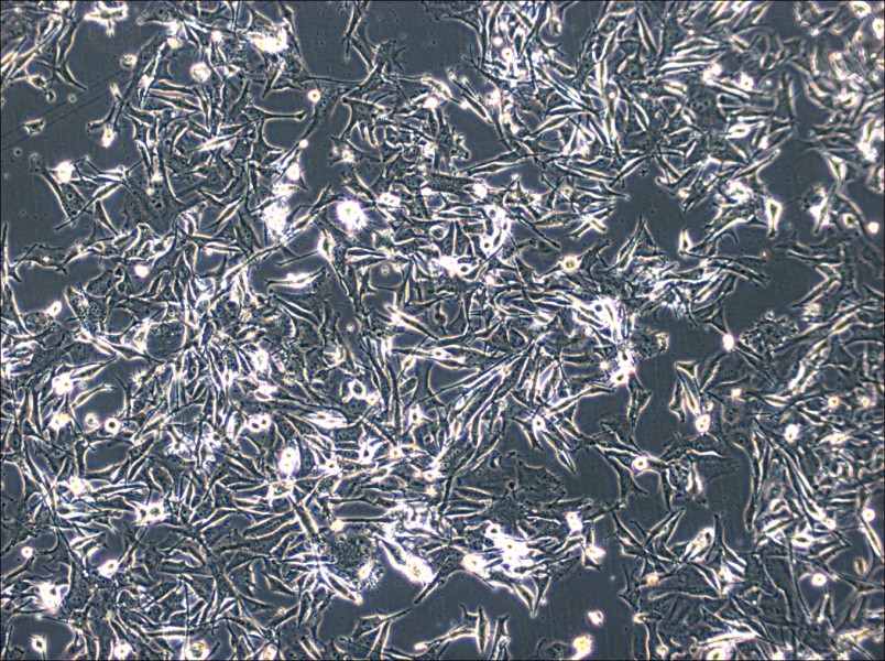 SK-MEL-2 Cell Complete MediumSK-MEL-2 Cell Complete Medium - 2