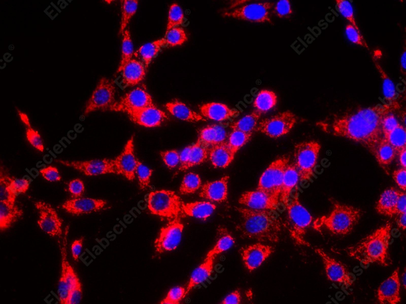 HSP-60 Polyclonal Antibody - 8