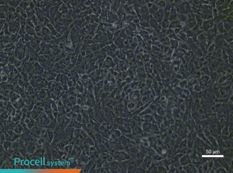 Mouse Pulmonary Microvascular Endothelial Cells (Primary cell immortalization)Mouse Pulmonary Microvascular Endothelial Cells (Primary cell immortalization) - 6