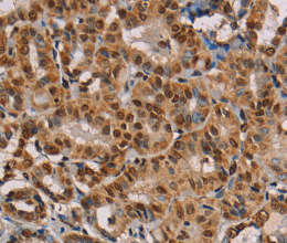 hnRNP G Polyclonal Antibody - 2