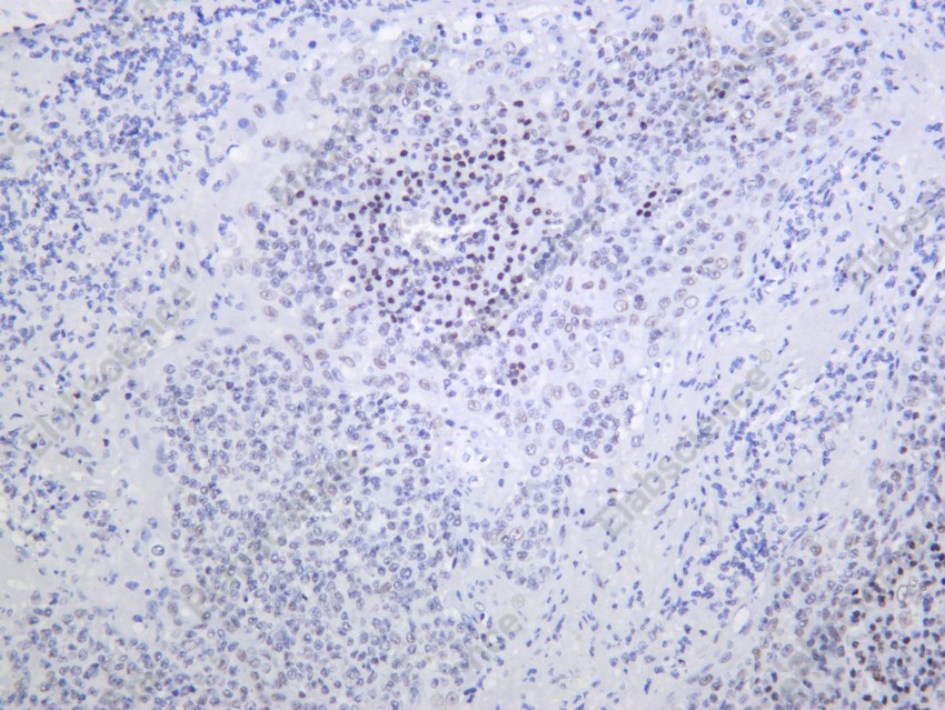 Recombinant BMI1 Monoclonal Antibody - 2