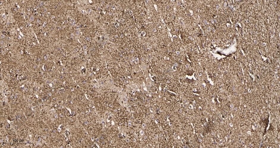 Recombinant GFAP Monoclonal Antibody - 2