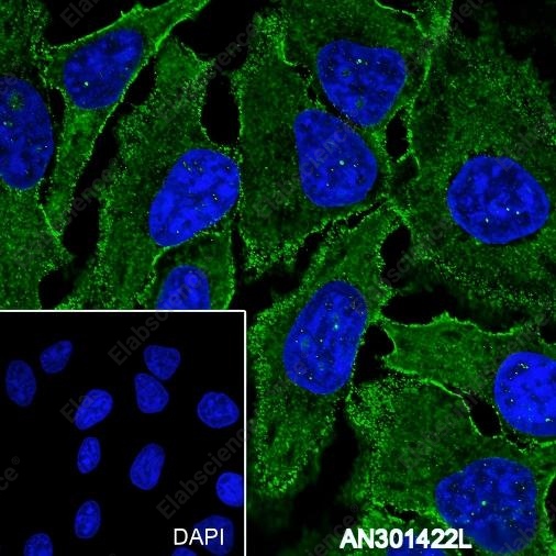 Recombinant TSHB Monoclonal Antibody - 3