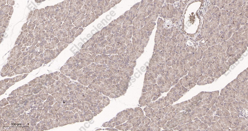 Recombinant PTEN Monoclonal Antibody - 2