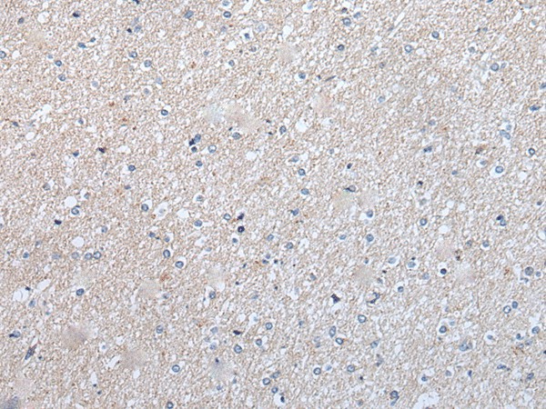 Immunohistochemistry of paraffin-embedded Human brain tissue  using ENPP2 Polyclonal Antibody at dilution of 1:50(?200)