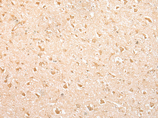 Immunohistochemistry of paraffin-embedded Human brain tissue  using MED6 Polyclonal Antibody at dilution of 1:30(?200)