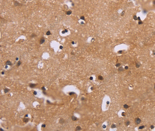 ERK1/2 Polyclonal Antibody - 3