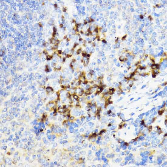 Immunohistochemistry of paraffin-embedded Mouse spleen using YKL-40 / CHI3L1 Polyclonal Antibody at dilution of  1:100 (40x lens).