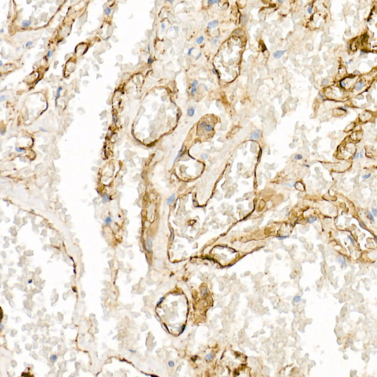 Immunohistochemistry of paraffin-embedded human lung using CD141/Thrombomodulin Polyclonal Antibody at dilution of 1:20 (40x lens).Perform high pressure antigen retrieval with 10 mM citrate buffer pH 6.0 before commencing with IHC staining protocol.