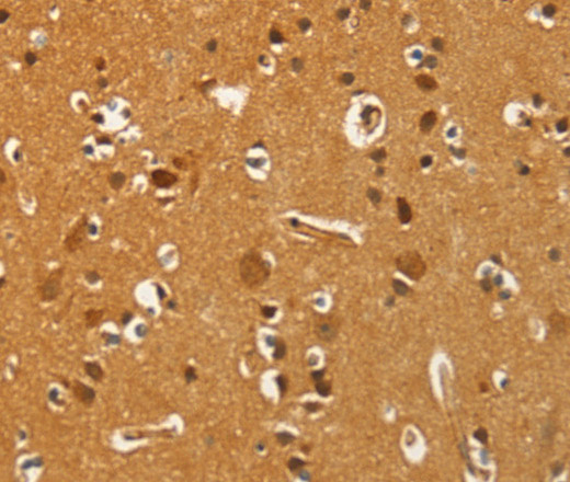 Immunohistochemistry of paraffin-embedded Human brain  tissue using PFKFB1 Polyclonal Antibody at dilution 1:60