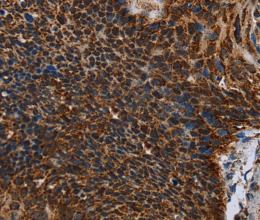 IDH2 Polyclonal Antibody - 2