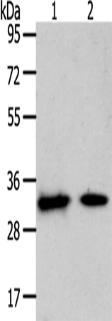 Western Blot analysis of Mouse heart and muscle tissue using SLC25A4 Polyclonal Antibody at dilution of 1:400