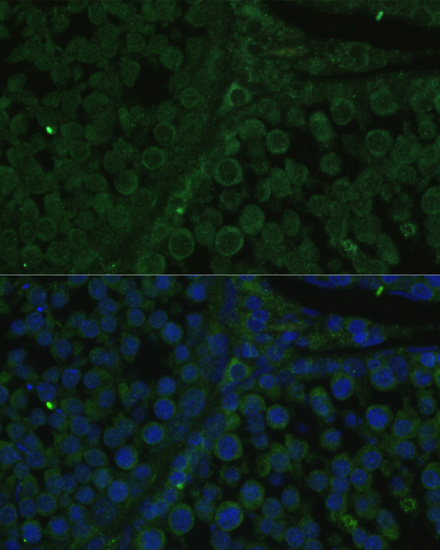 Immunofluorescence analysis of Rat testis cells using IGF2BP2 Polyclonal Antibody at dilution of  1:100. Blue: DAPI for nuclear staining.