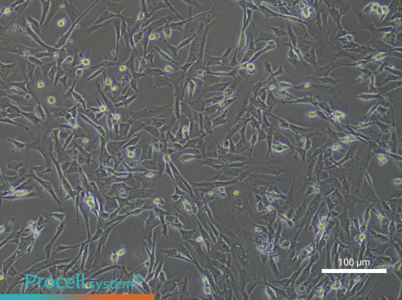 Mouse Hepatic Stellate (Primary cell immortalization) Cell Complete Medium - 2