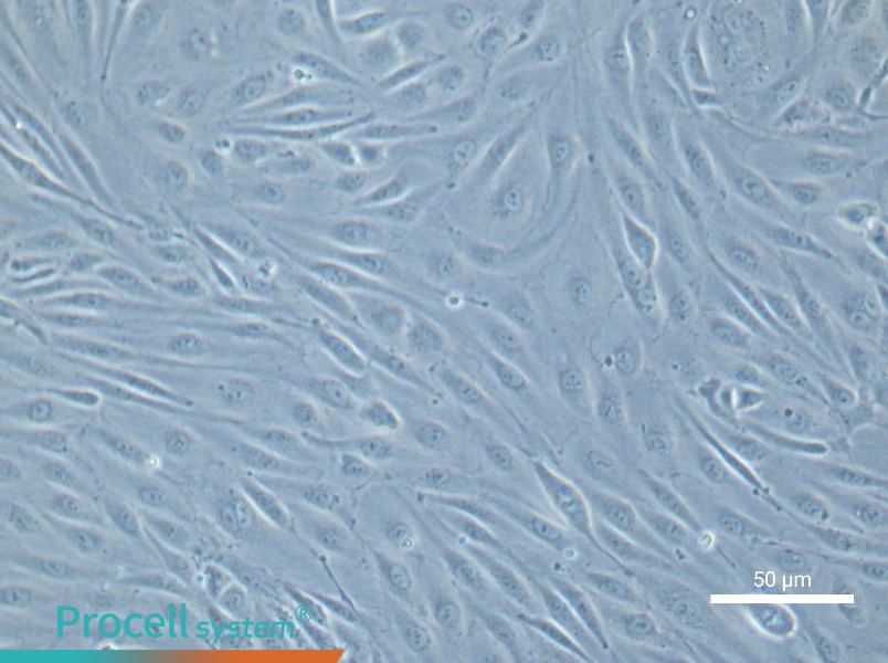 Human Umbilical Vein Endothelial Cell Complete Medium - small - 8
