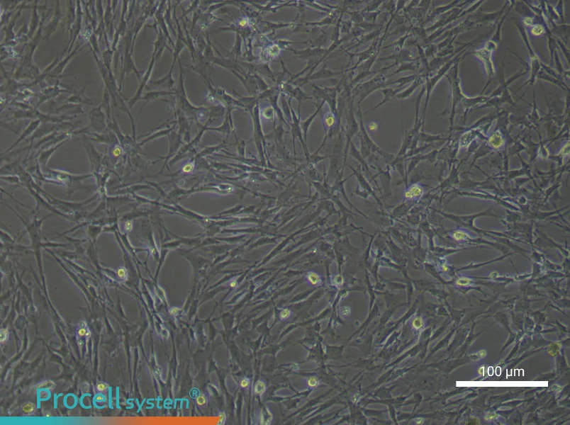 Rat Brain Fibroblast Complete Medium - 2
