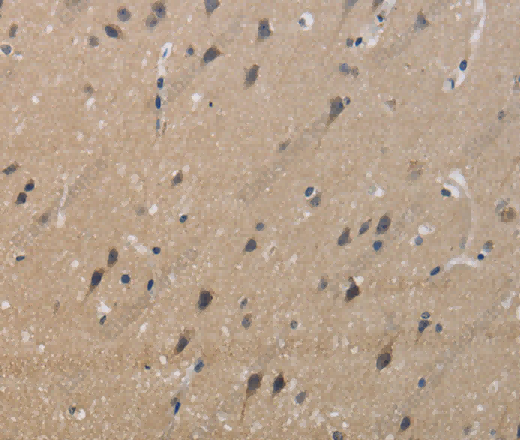 KCNMB4 Polyclonal Antibody - 3