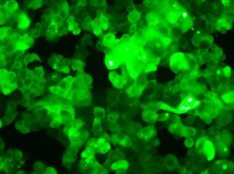 MCF-7-GFP Cell Complete Medium - 5