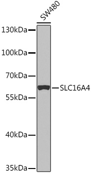 Western blot analysis of extracts of SW480 cells using SLC16A4 Polyclonal Antibody at 1:1000 dilution.