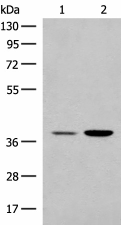 Western blot analysis of HEPG2 and K562 cell lysates  using MRM1 Polyclonal Antibody at dilution of 1:400