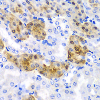 Immunohistochemistry of paraffin-embedded mouse kidney using HPD Polyclonal antibody at dilution of 1:100 (40x lens).Perform microwave antigen retrieval with 10 mM PBS buffer pH 7.2 before commencing with IHC staining protocol.