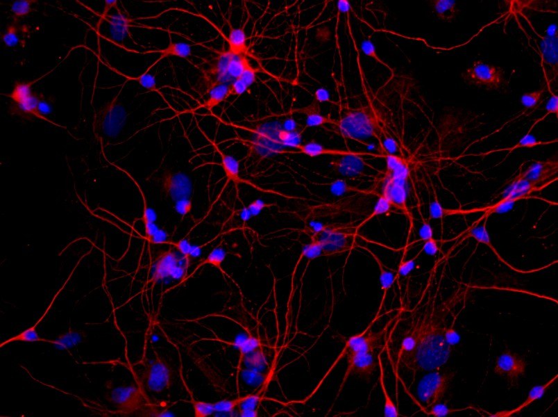 Rat Cortical Neuron Complete MediumRat Cortical Neuron Complete Medium - 2