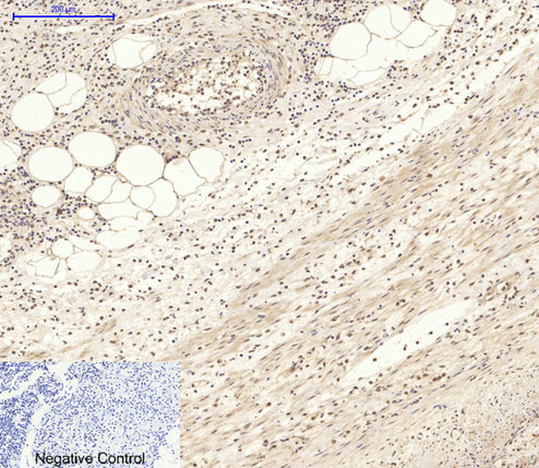 Immunohistochemistry of paraffin-embedded Human appendix tissue using Pan-Akt Polyclonal Antibody at dilution of 1:200.