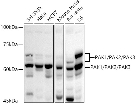 Western blot analysis of extracts of various cell lines using PAK1/PAK2/PAK3 Polyclonal Antibody at 1:1000 dilution.