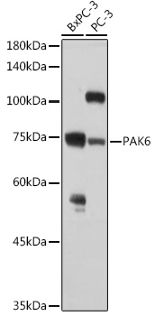 Western blot analysis of extracts of various cell lines using PAK6 Polyclonal Antibody at 1:1000 dilution.