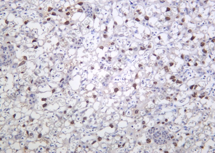 Recombinant PPAR-γ Monoclonal Antibody - 1