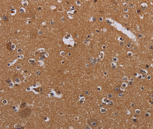 Immunohistochemistry of paraffin-embedded Human brain tissue using MAGEB10 Polyclonal Antibody at dilution 1:60