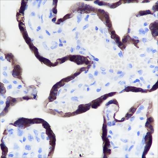 Recombinant Placental Lactogen Monoclonal Antibody - 2
