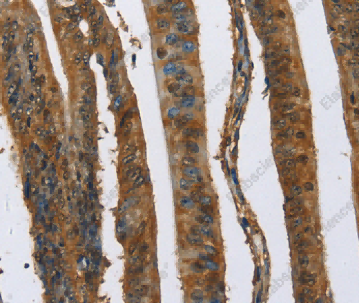 CAST Polyclonal Antibody - 3