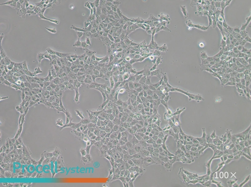 HBL-100 Cell Complete Medium - 1