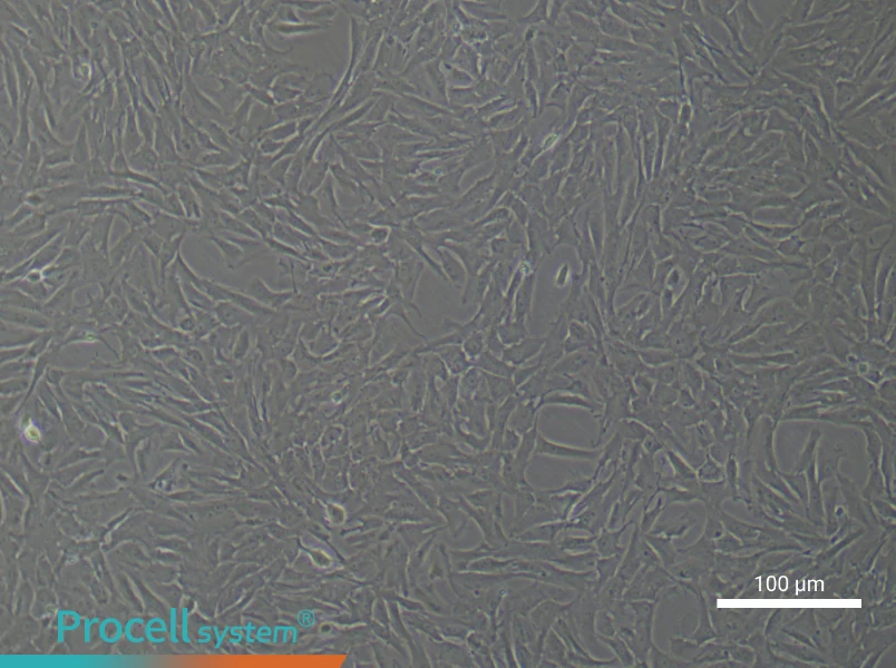 Rat Pulmonary Arteriolar Smooth Muscle Cell Complete Medium - 2