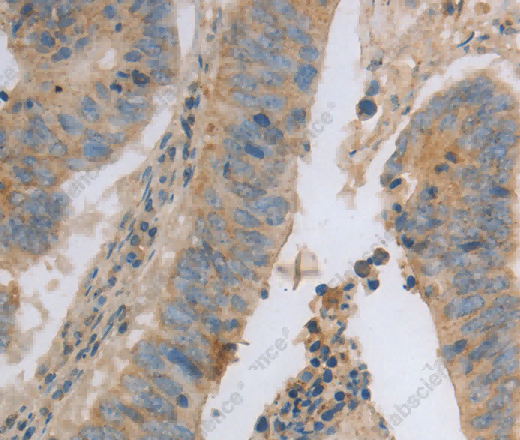 MAGED1 Polyclonal Antibody - 3