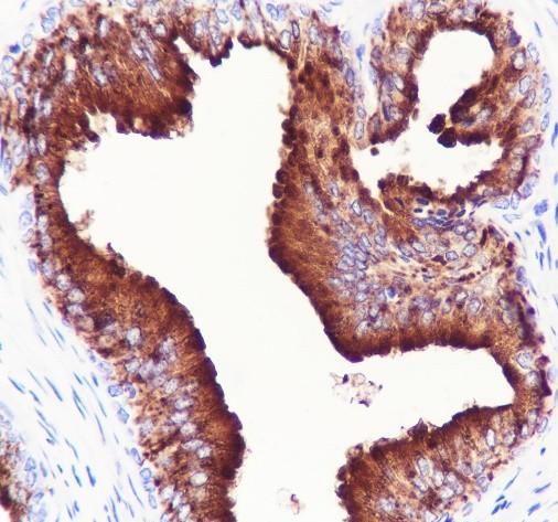 Recombinant KIR3DL1 Monoclonal Antibody - small - 2