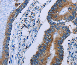 IDH2 Polyclonal Antibody - 3