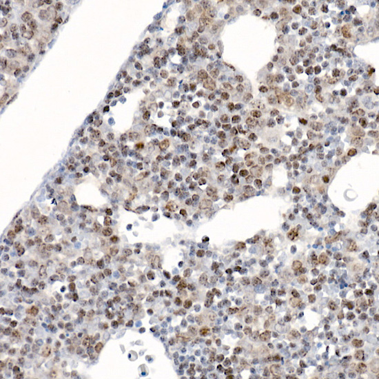 Immunohistochemistry of paraffin-embedded mouse fetal liver using Survivin Polyclonal antibody at dilution of 1:25 (40x lens).Perform high pressure antigen