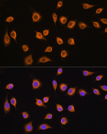 Immunofluorescence analysis of L929 cells using SLC20A1 Polyclonal Antibody at dilution of  1:100. Blue: DAPI for nuclear staining.