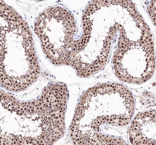 Recombinant Rad51 Monoclonal Antibody-searchlist-2
