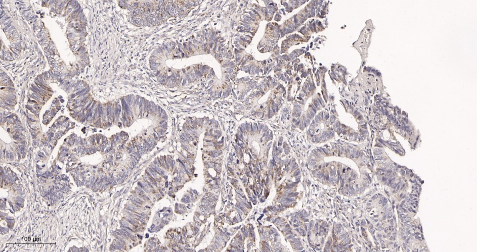 Recombinant Glutaminase C Monoclonal Antibody - small - 2