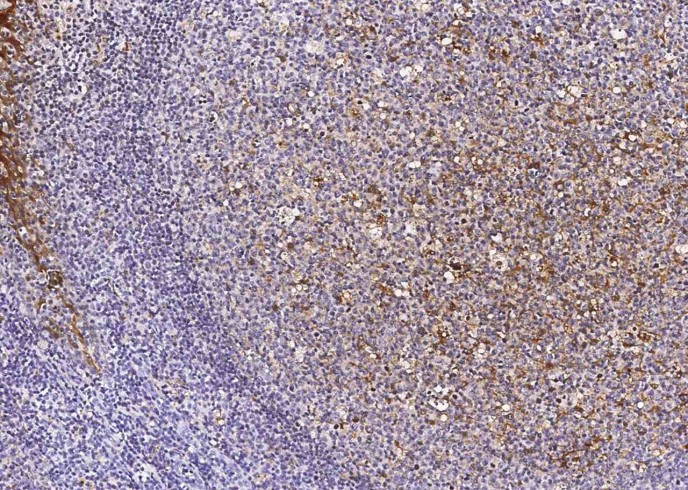 Cystatin A/CSTA Monoclonal Antibody-searchlist-1