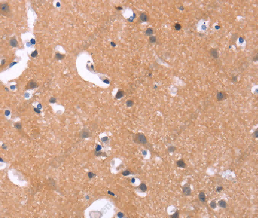 MAPK11 Polyclonal Antibody - 3